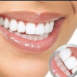 Гэрэлт Инээмсэглэл шүдний эмнэлэг